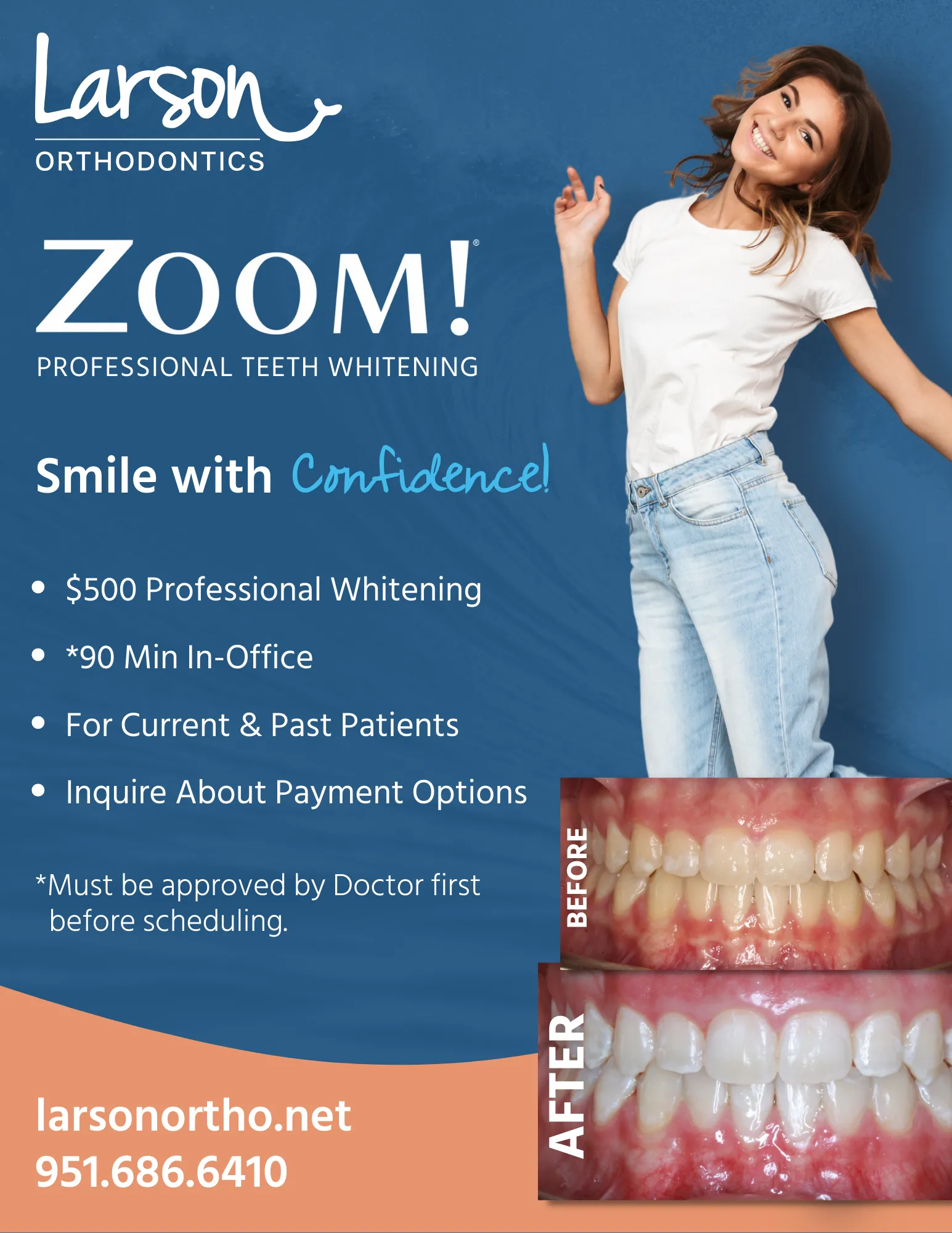Zoom Teeth Whitening flyer for Riverside, CA